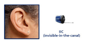 Does kaiser permanente cover hearing aids kaiser permanente veradale pharmacy